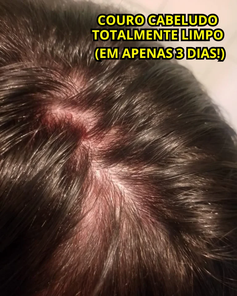 Gabriel — depois
